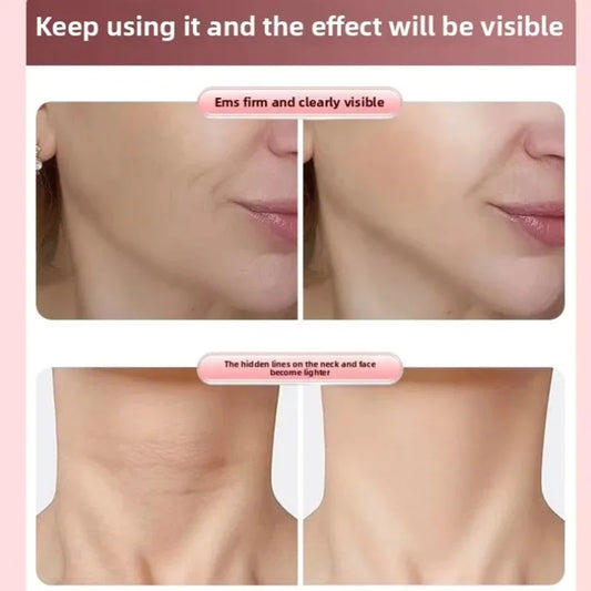 V-Glow EMS Facial Sculptor